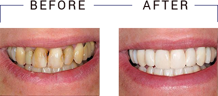 Alan Wolkoff, D.M.D. | Oral Exams, Teeth Whitening and Cosmetic Dentistry